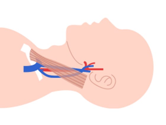 首の両側にある内頸静脈を圧迫