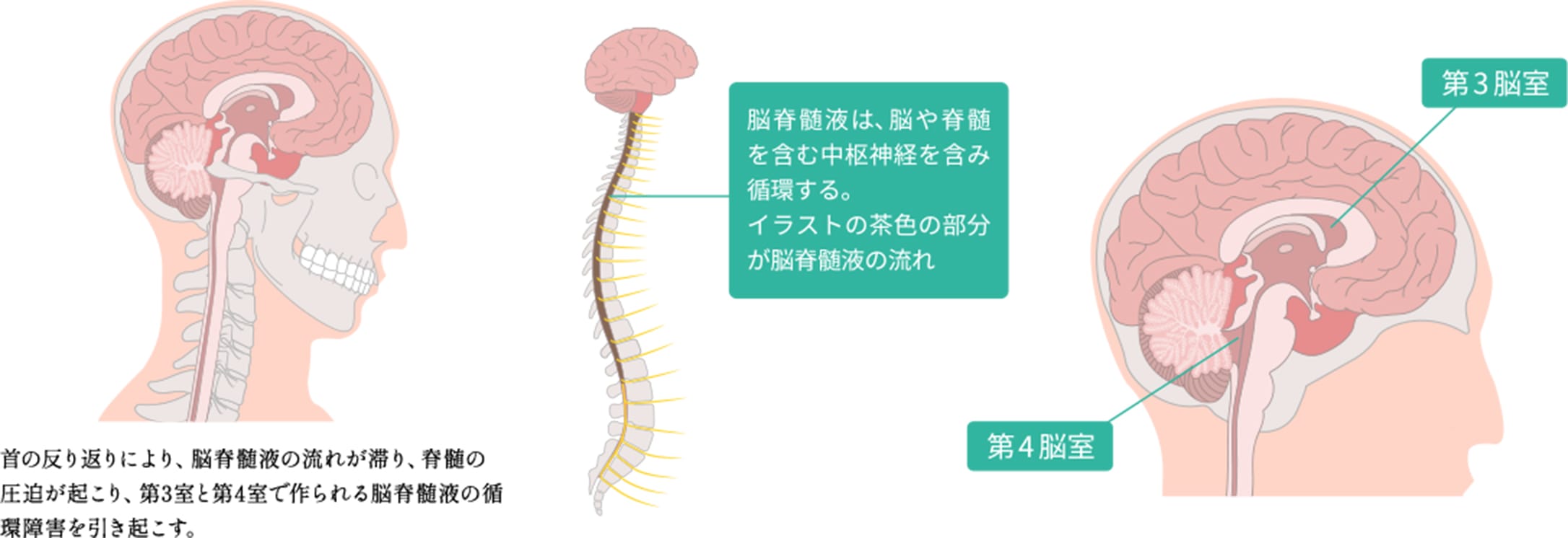 原因不明の症状を引き起こすメカニズム